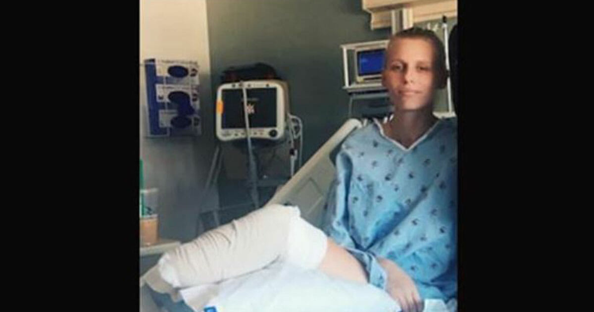 Warning: Woman’s Legs Amputated after Using Common Product – A Global Call to Action for Women