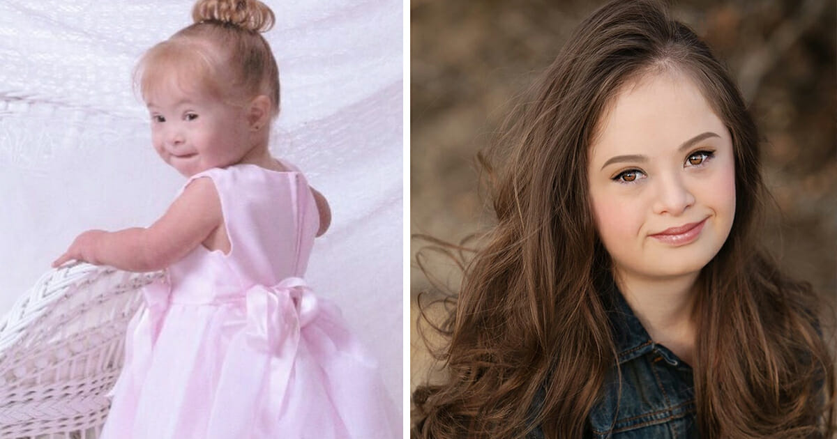 From Institution to Runway: The Incredible Journey of a Girl with Down syndrome