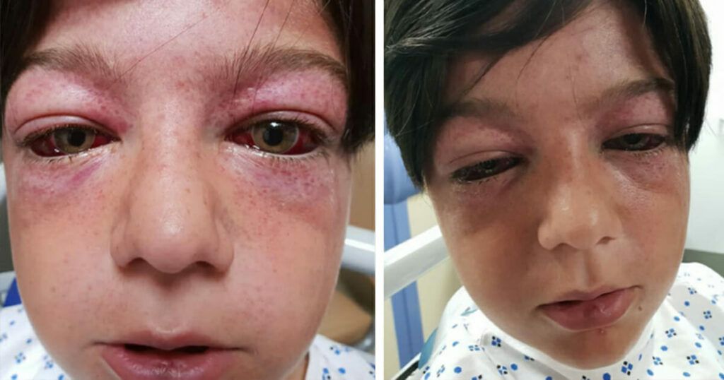 Alien Eyes: The Latest Playground Craze Sparking Concern Among Parents