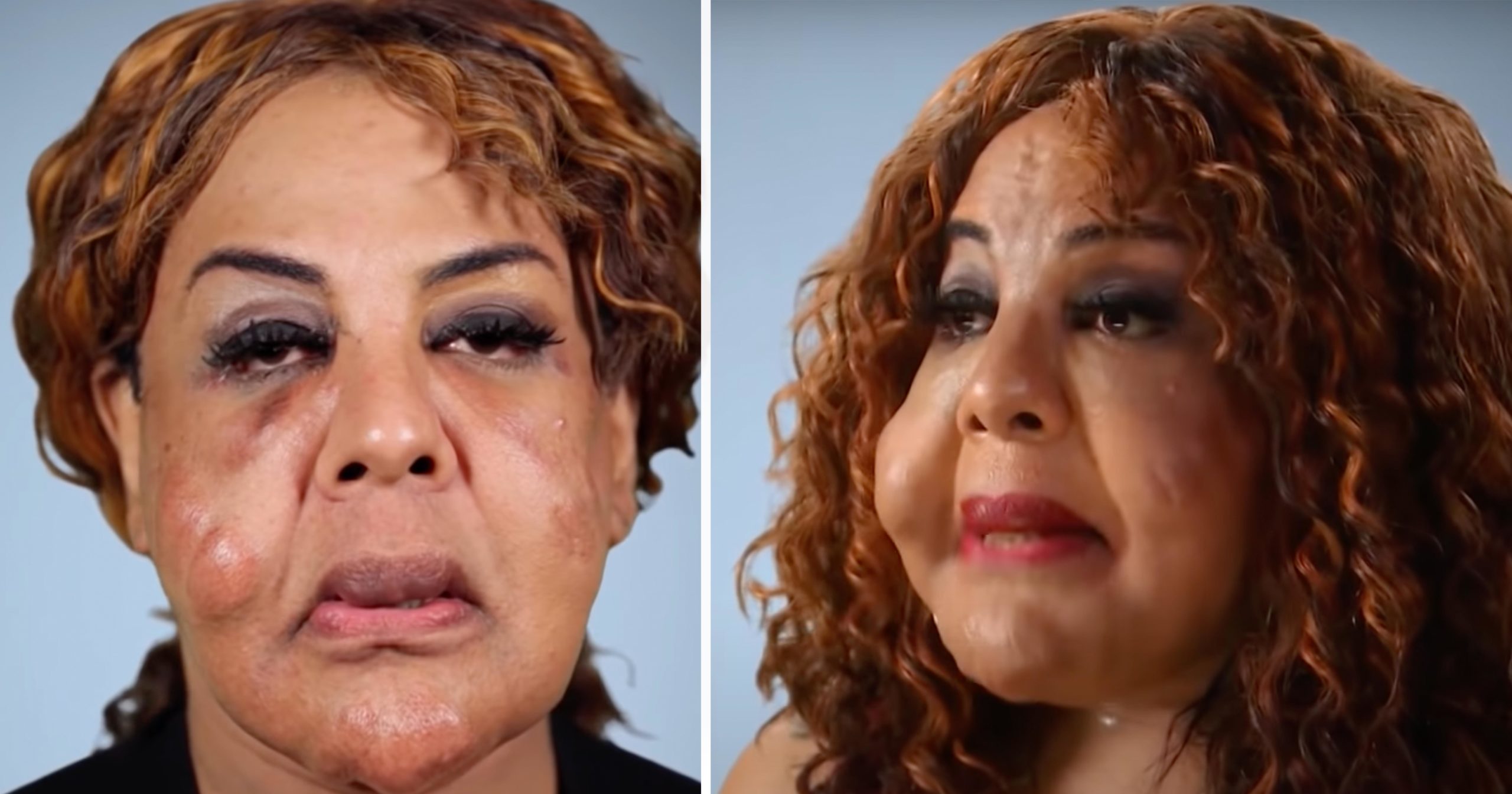 From Cement Disaster to Blessing: The Incredible Transformation of a Teenage ‘Doctor’