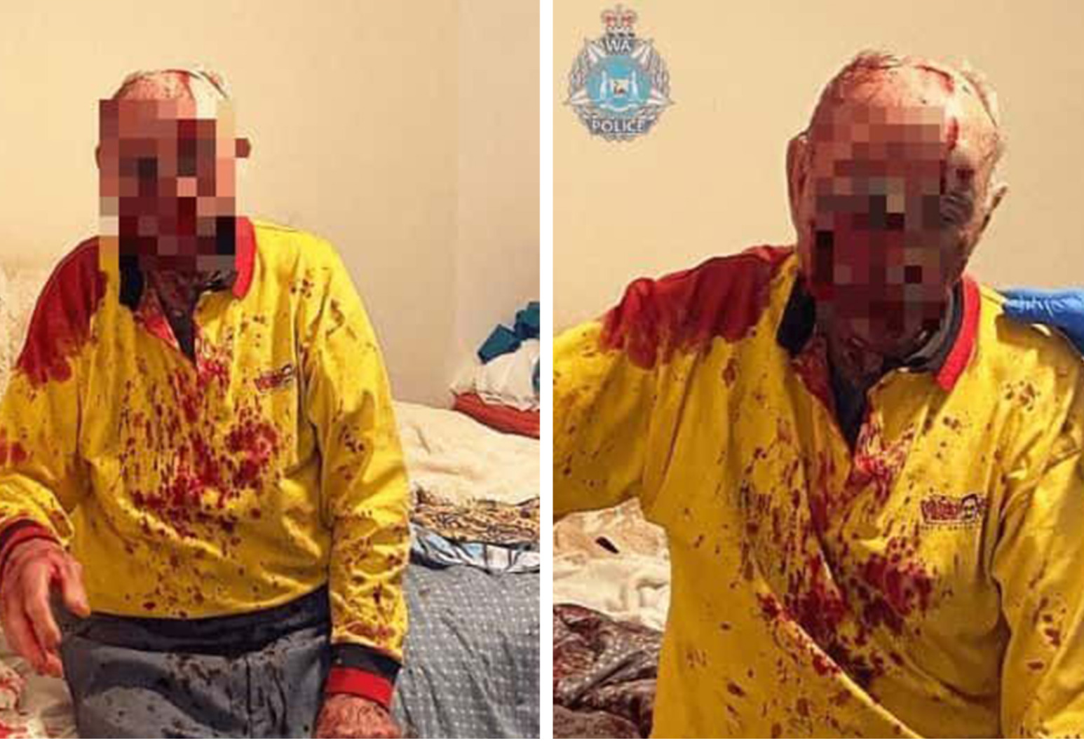 Savage Attack Leaves Emilio (84) Fighting for His Life in Coma