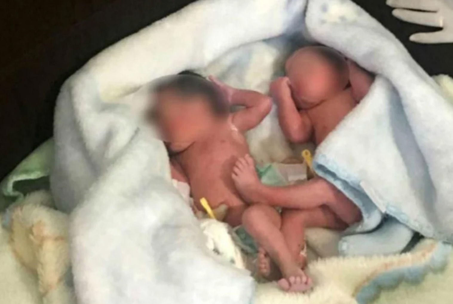 Startled Women Mistake Howling in Bushes for Abandoned Newborn Twins