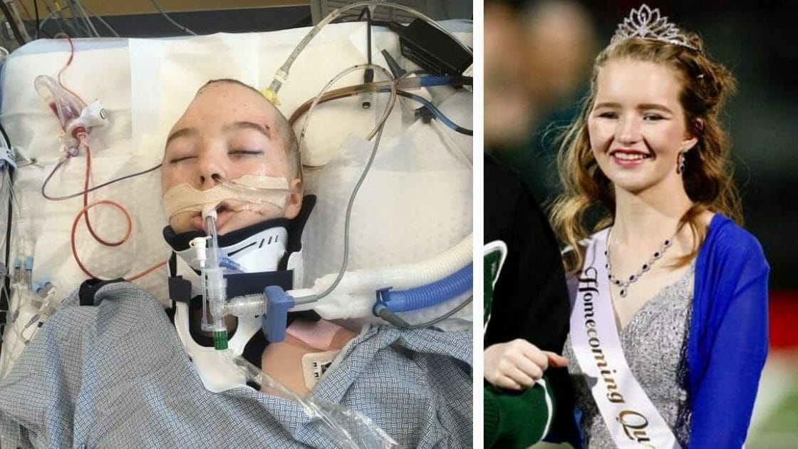 Teen shot in head by classmates crowned while they frown