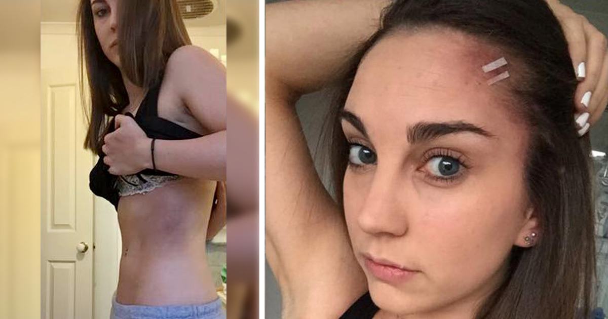 Brave 25-Year-Old Woman Fights Off Attacker Trying to Rape Her