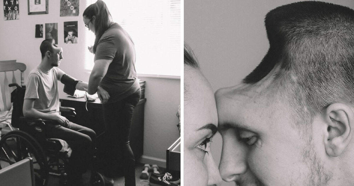 Deadly Drink: How One Father Escaped Death with a Hole in His Head