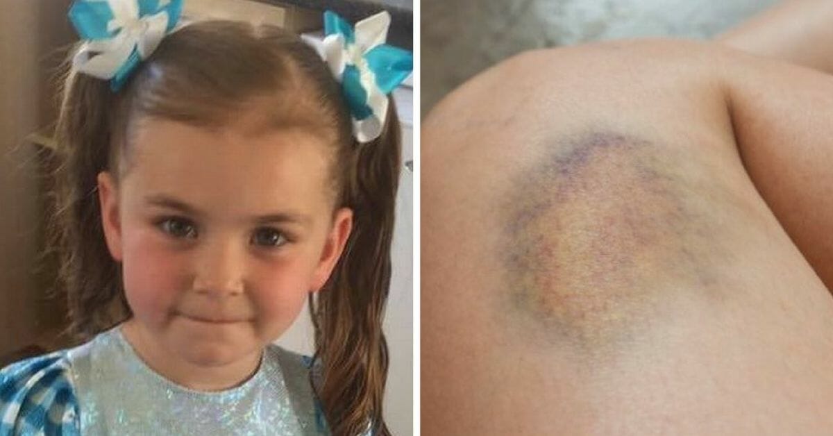 The Tragic Story of a 6-Year-Old: Doctor Accuses Mother of Paranoia, Leading to Heartbreaking Outcome