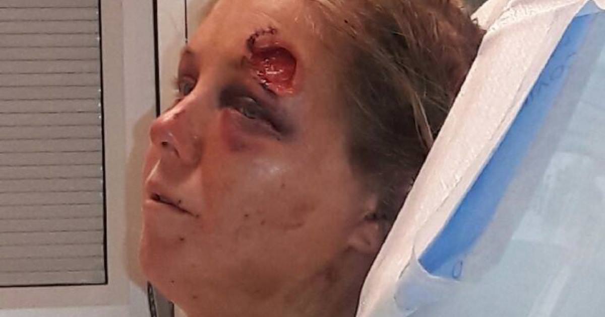 The Ultimate Betrayal: Inviting Friends to Assault His Girlfriend – Seconds Later, Horror Unfolds