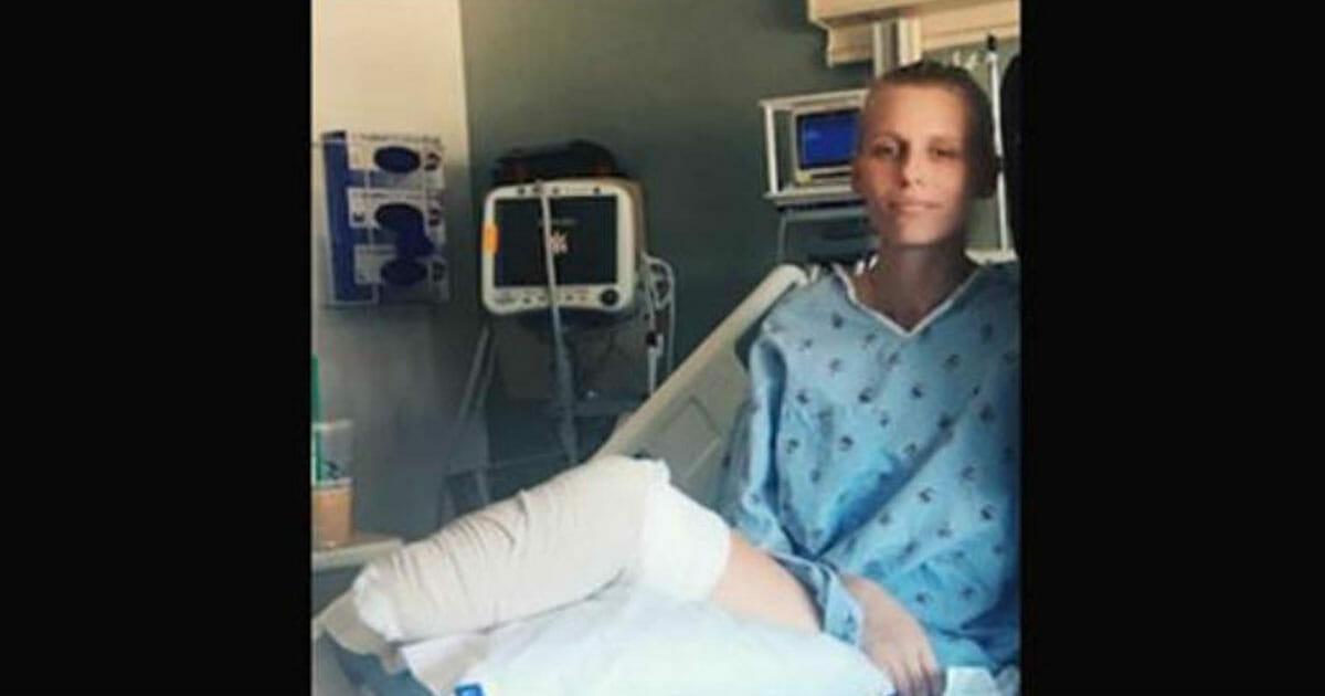 Warning: Woman’s Legs Amputated After Using Popular Product – Her Story Urges Women to Beware